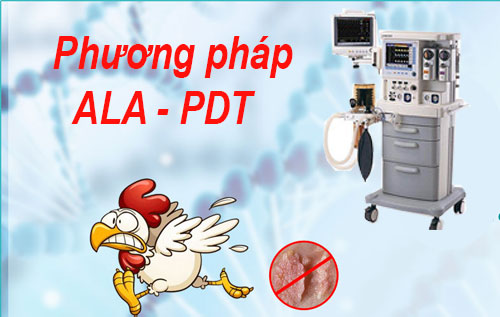 Trị dứt điểm bệnh sùi mào gà ở miệng, môi, lưỡi, họng bằng phương pháp ALA-PDT hiệu quả