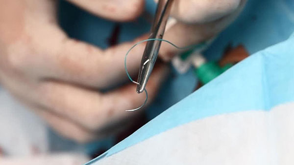 Médico con puntos de sutura