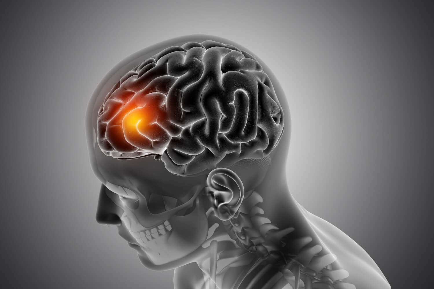 Arte gráfico de un cerebro masculino resaltado en la parte delantera. 