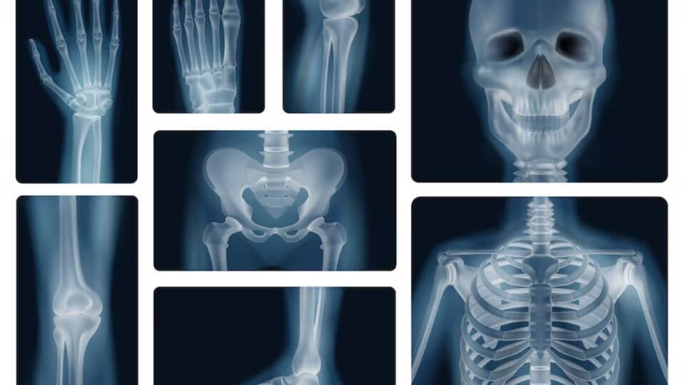 huesos humanos radiografías realistas