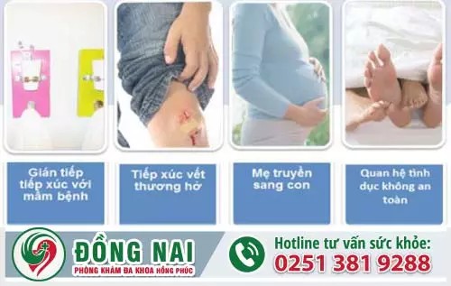 Nguyên nhân và con đường lây nhiễm mụn rộp sinh dục