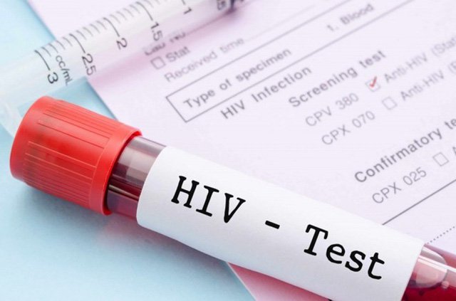 Xét nghiệm hiv