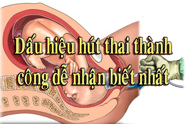 Dấu hiệu hút thai thành công