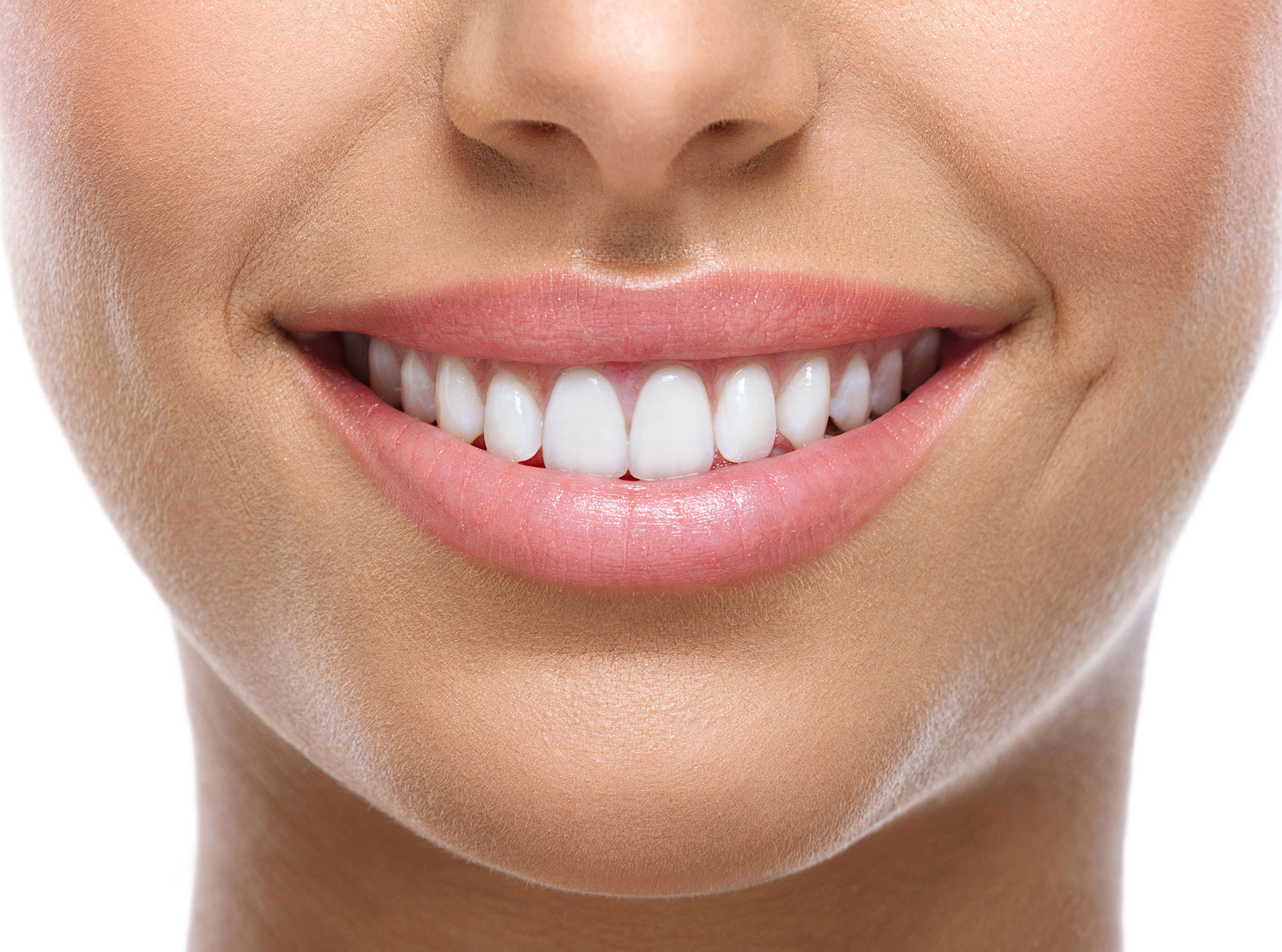 Veneers – Hollywood Smile image
