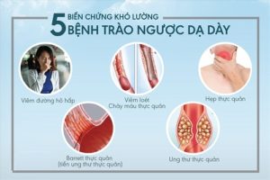Trào ngược dạ dày thực quản có nguy hiểm không?
