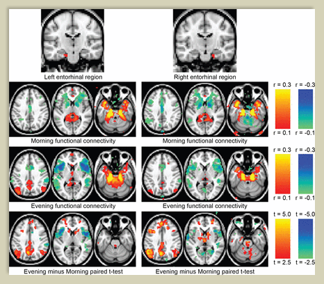 brain on meditation