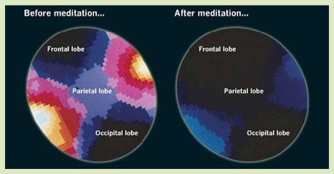 meditation