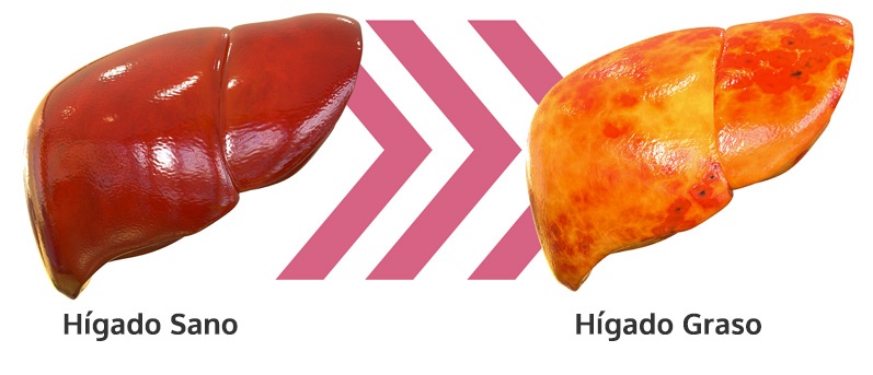 HIGADOSANO_2