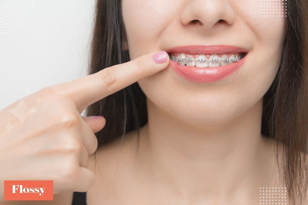 How Much Do Braces Cost With and Without Insurance?