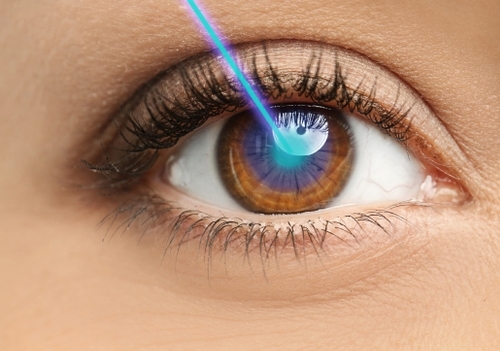 How Much Does LASIK Cost In Chicago 2021 Laser Vision Correction 