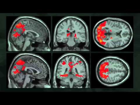 brain on languages