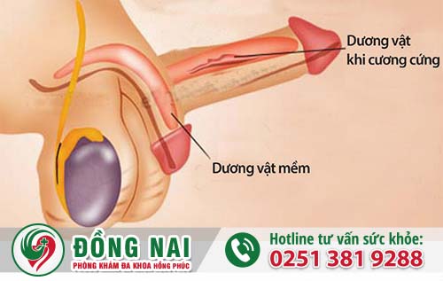 Dương vật không cứng là bệnh gì?