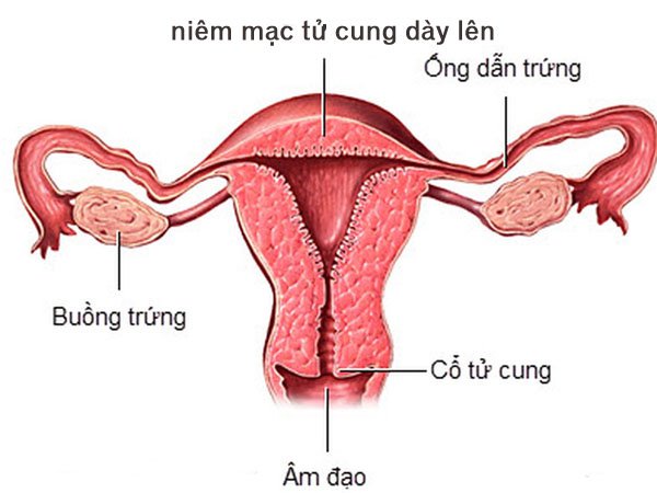 Niêm mạc tử cung dày bao nhiêu thì có kinh?