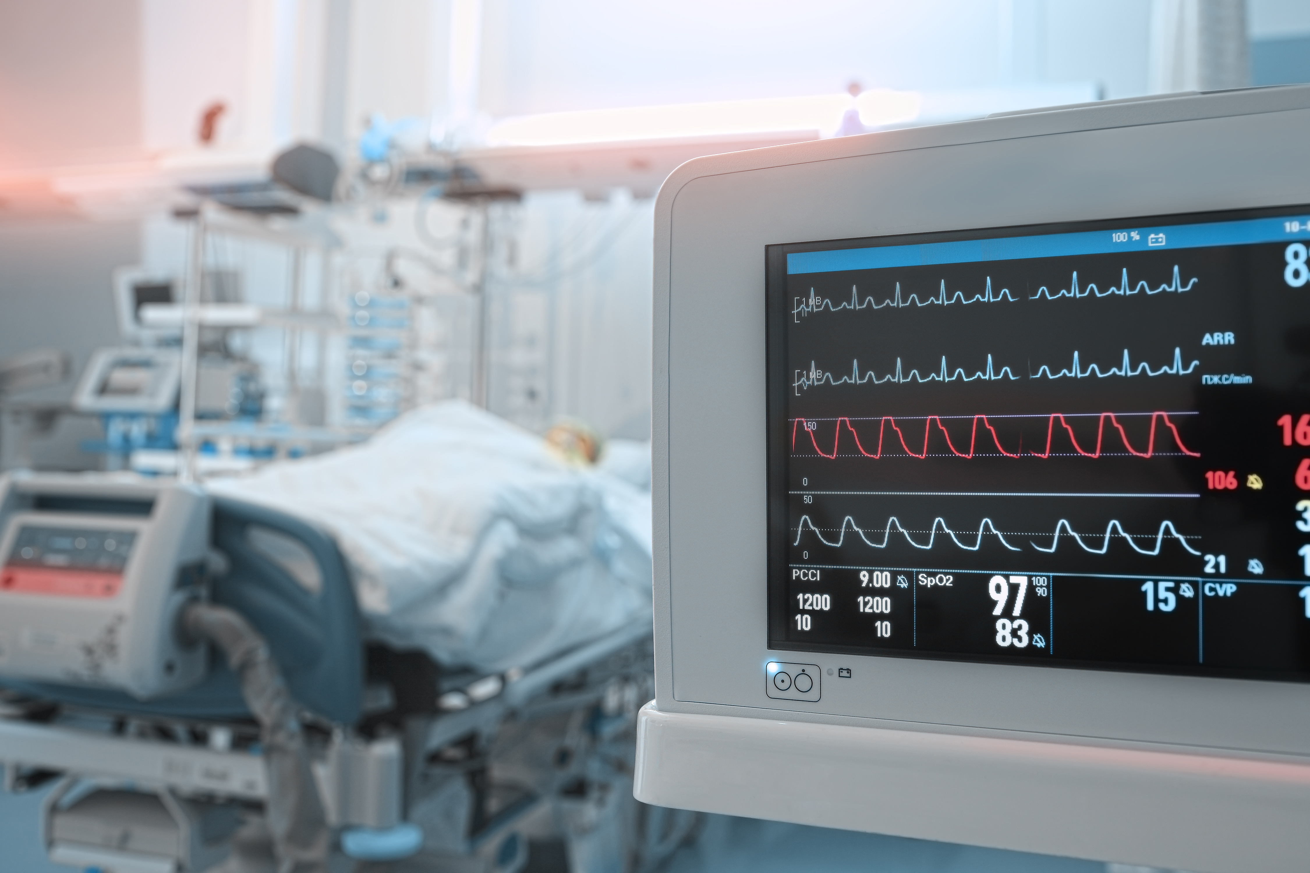 ECG in hospital