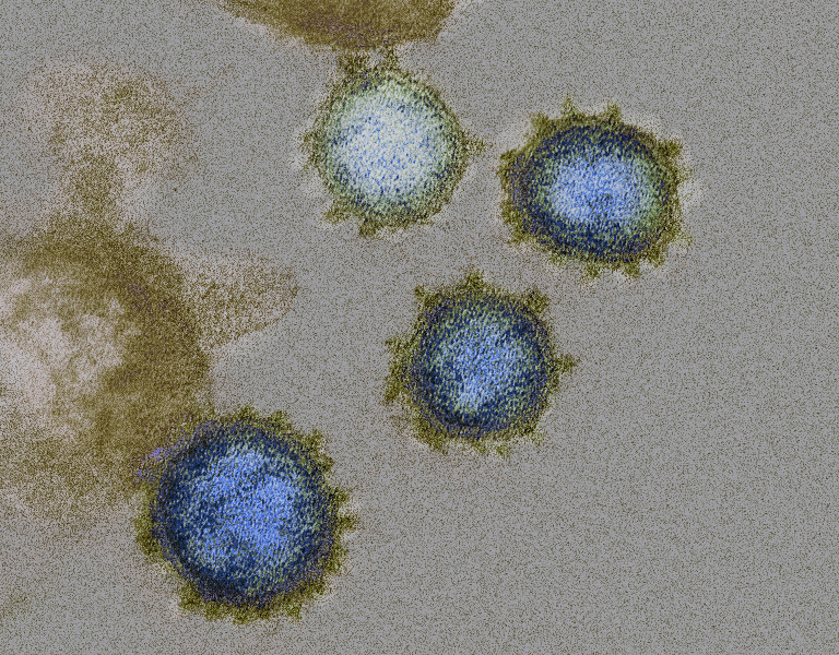 AGS-03 Antiviral - demonstration