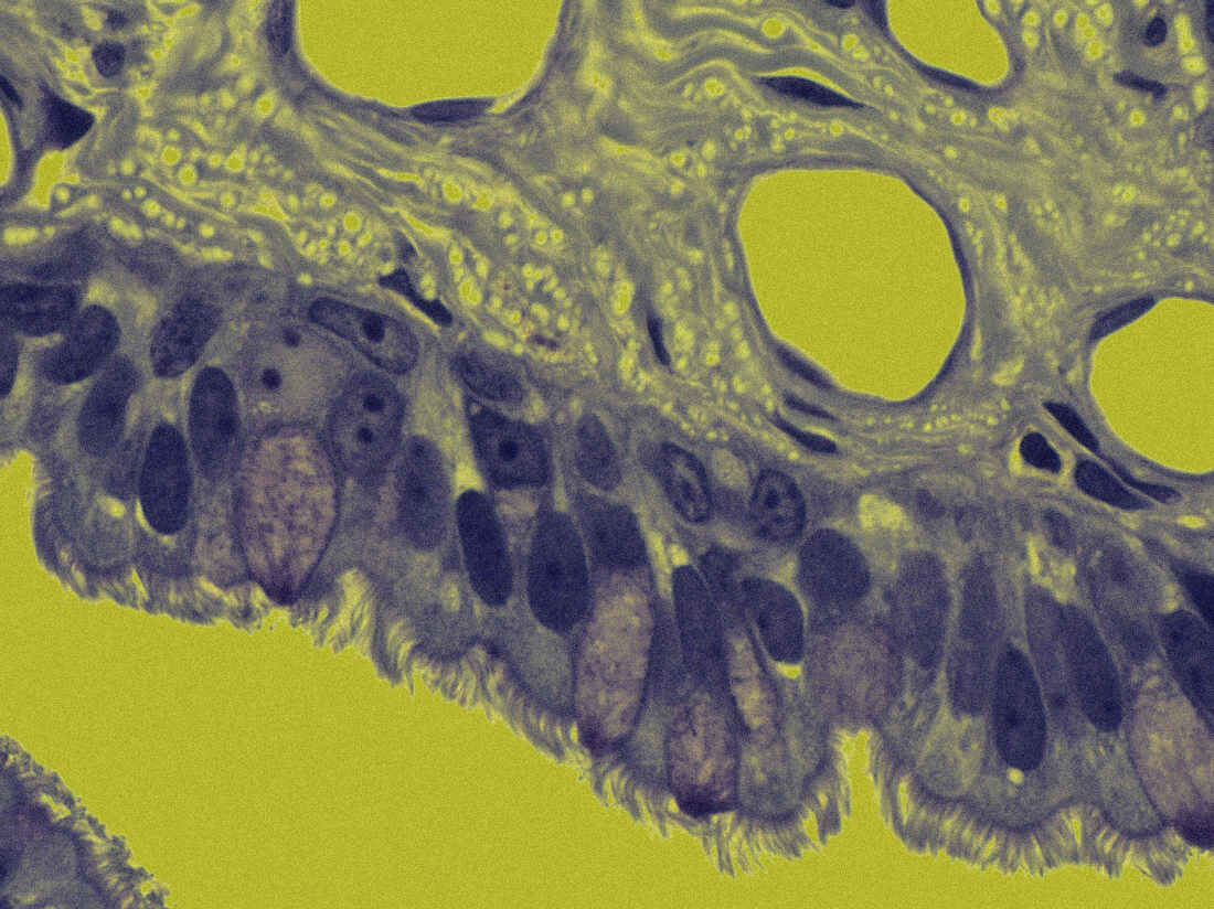 Bronchial Mucosa