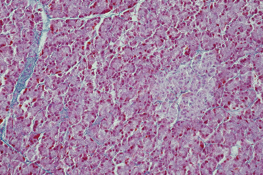 Liver