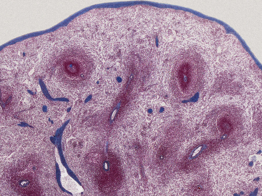 Spleen