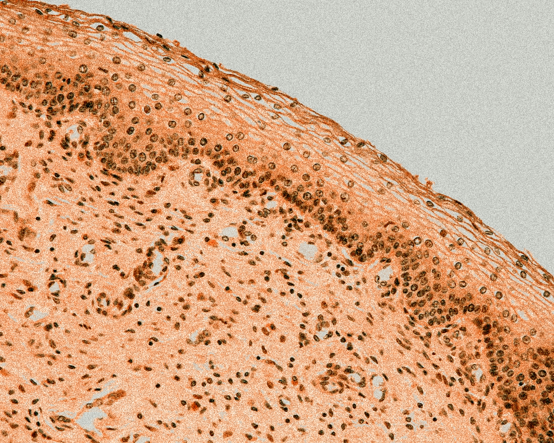 Vaginal mucosa