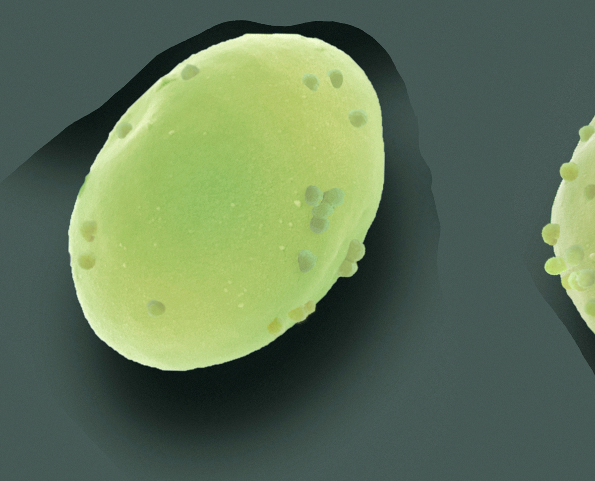 Illustration of Chlorella cells budding MEV from their surface - AGS2022.