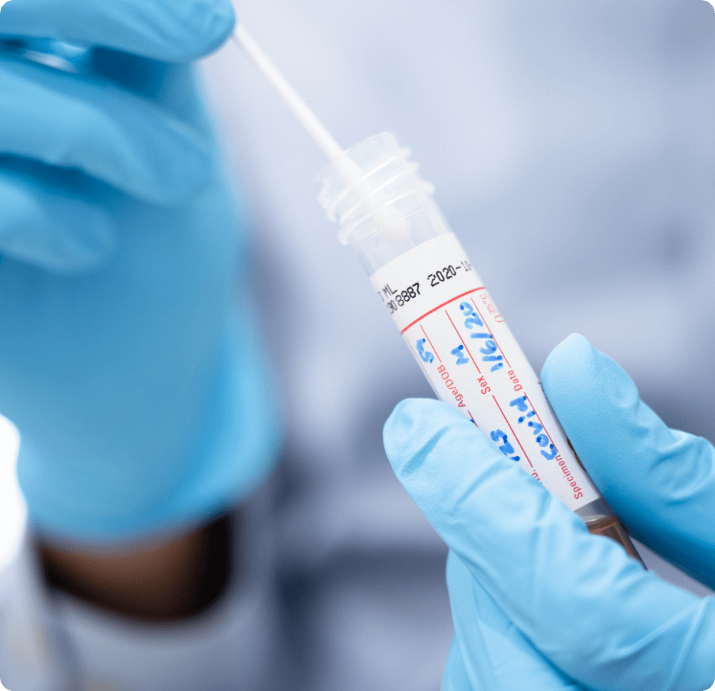 concimed lab technicia inserting nasal swab from pcr covid-19 test into a labeled test tube