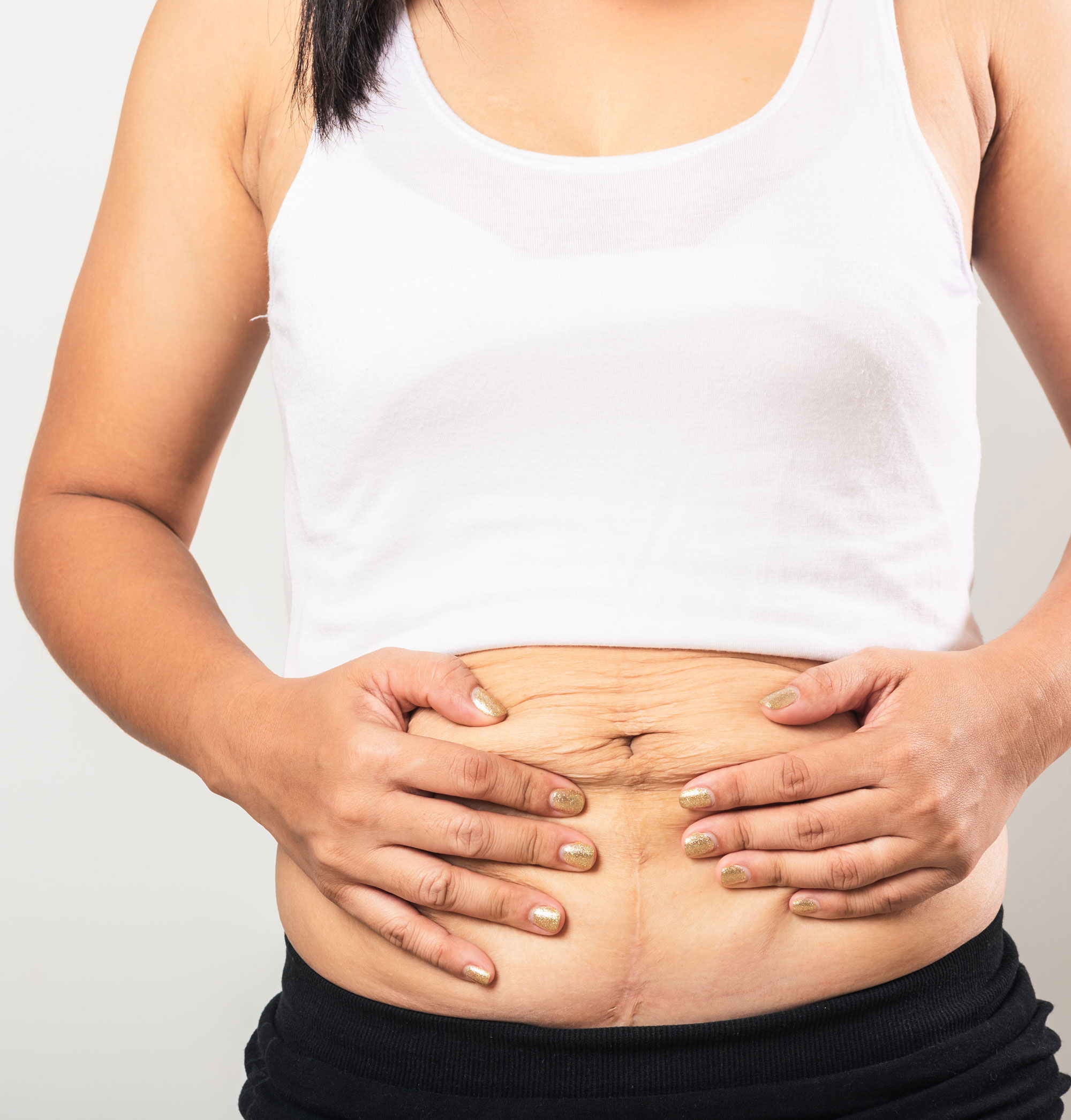 woman squishing flabby belly
