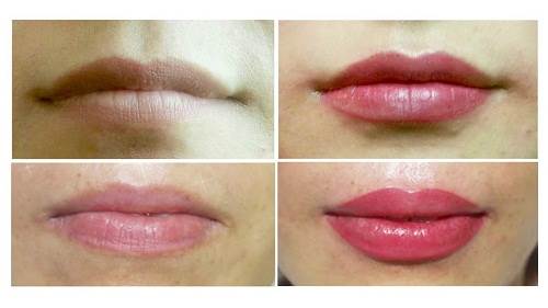 địa chỉ phun môi Kim Ty Spa Salon