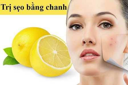 Làm đẹp da với chanh tươi để làm mờ sẹo thâm