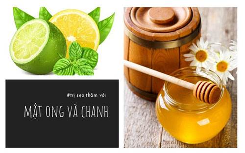 tri seo tham bang mat ong chanh2