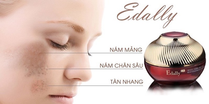 Kem trị nám Edally có tốt không