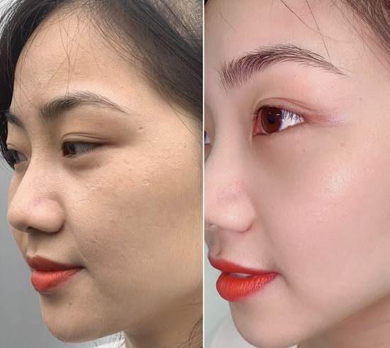 Review kem chống nắng KYS có tốt không