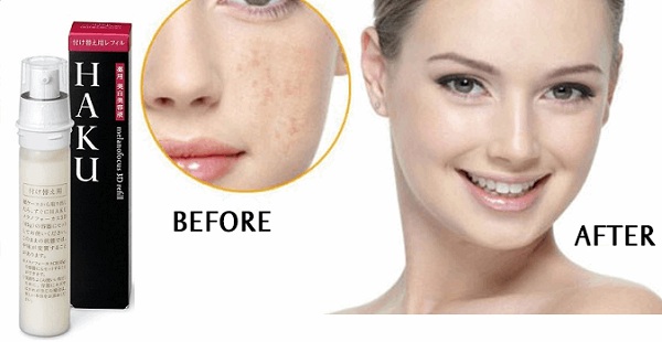 Kem trị nám Shiseido HAKU Melanofocus CR