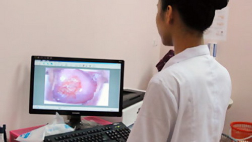 Có phải kiêng chuyện ấy khi bị viêm lộ tuyến cổ tử cung?