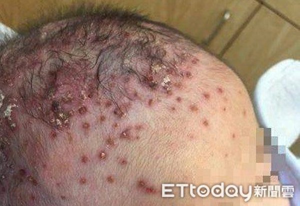 'Tranh thủ' với gái lạ, người cha mắc 4 bệnh tình dục khiến con nhỏ cũng phải chịu hậu quả - 1