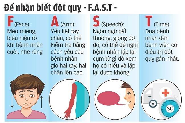 FAST là một quy tắc để nhận biết bệnh đột quỵ