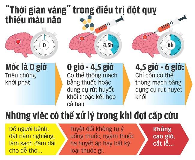 triệu chứng tai biến mạch máu não