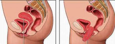 Phụ nữ đau khi giao hợp: Khi nào cần khám? - 2