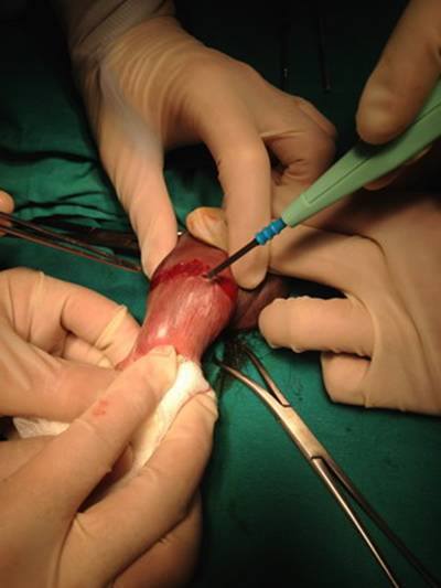 Thử nghiệm tư thế khó, đức ông chồng cấp cứu do 'súng' gãy gập