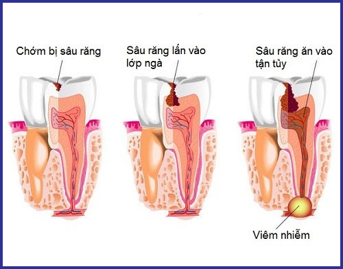 Những bài thuốc từ cây chanh