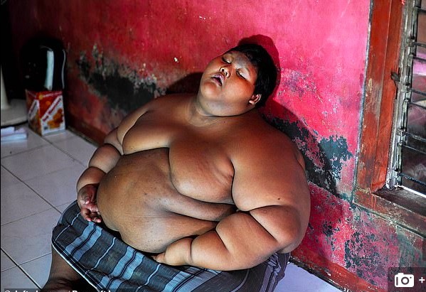 Hình ảnh không ngờ sau giảm cân của cậu bé nặng gần hai tạ