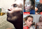 Thực hư việc uống và bôi nước tiểu để giảm cân và trị mụn