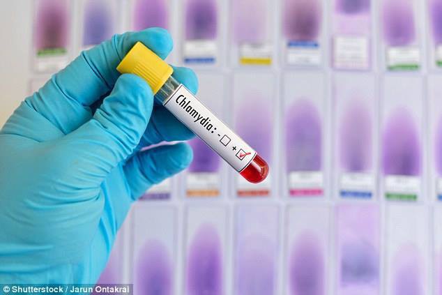 Chlamydia làm tăng gấp đôi nguy cơ ung thư buồng trứng - 1