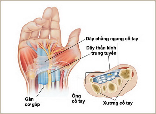 Đau cổ tay cần đi khám chuyên khoa xương khớp để dùng thuốc thích hợp.