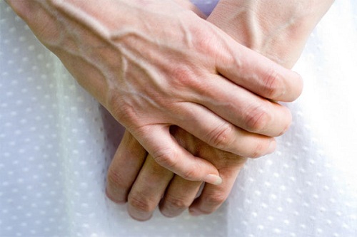 Tĩnh mạch nổi nhiều dưới da tay thường là biểu hiện cho thấy chất thải đọng dưới lưng và eo.