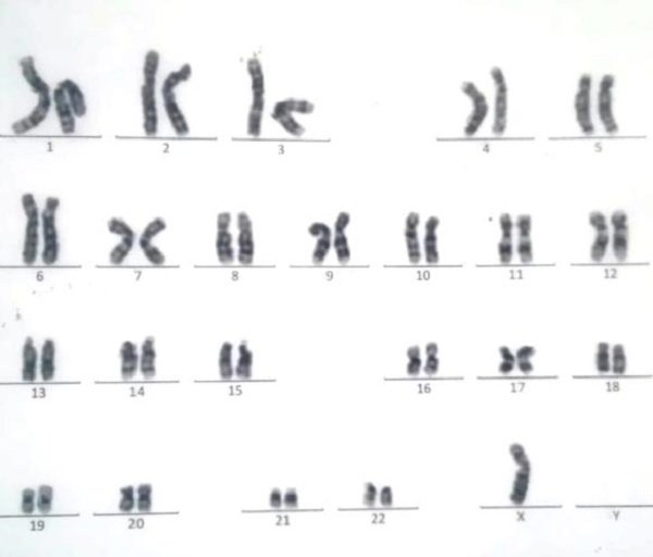 Suy giảm nội tiết tố nữ: Dấu hiệu và nguyên nhân do đâu - 7