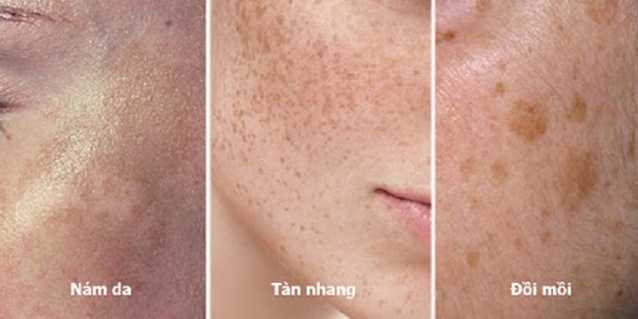 Suy giảm nội tiết tố nữ: Dấu hiệu và nguyên nhân do đâu - 8
