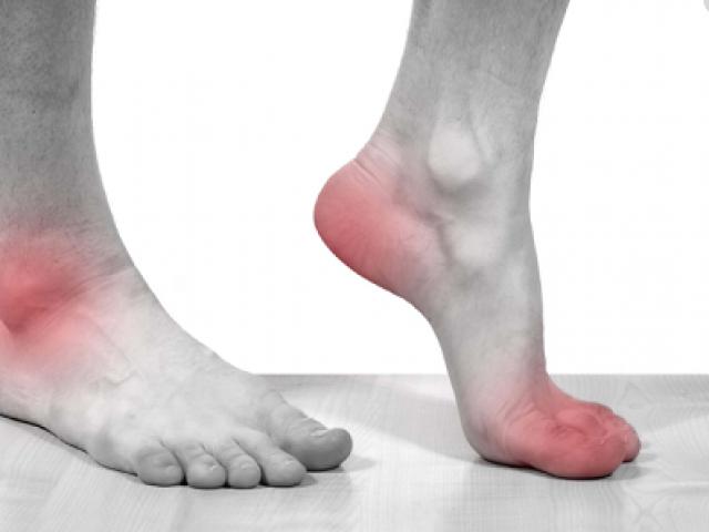 Bệnh gout nên ăn gì? Thực phẩm tốt cho người bệnh gout