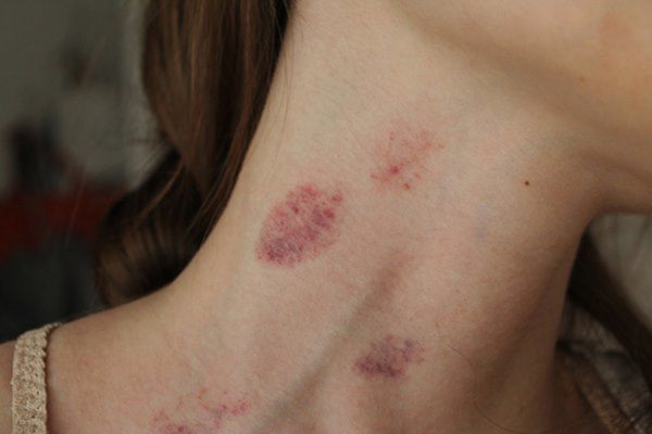 Khi 'quan hệ' có 1 bộ phận là 'vùng cấm hôn', thích đến mấy vợ chồng cũng đừng chạm vào - 1
