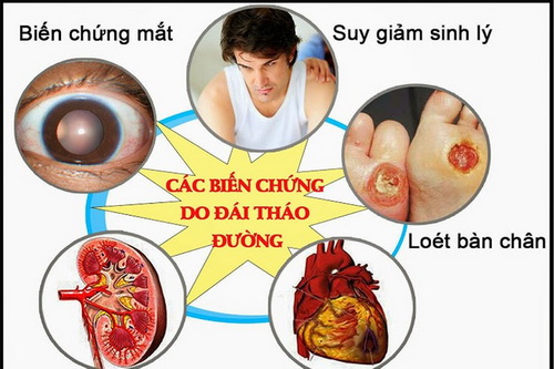 Các biến chứng của đái tháo đường.