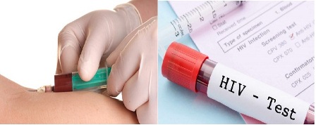 chẩn đoán HIV